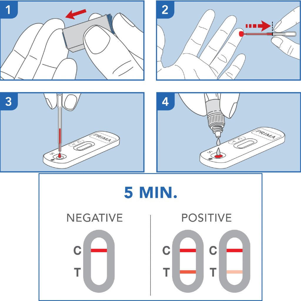PRIMA Prostate PSA Home Test Kit