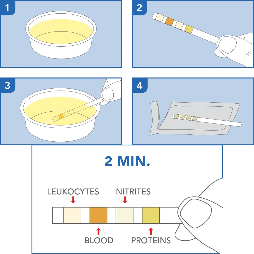 PRIMA Urinary Tract Infections (UTI) Home Test Kit